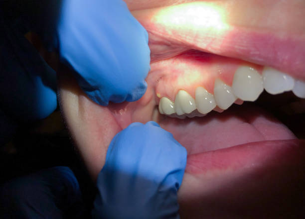 Best After-Hours Dental Trauma Care in Louise, TX