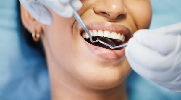 Best Emergency Root Canal Treatment in Louise, TX