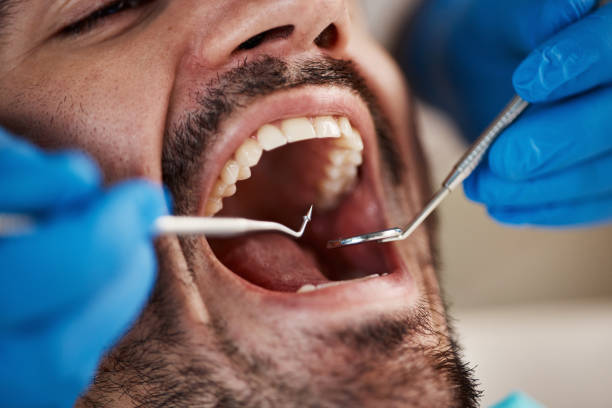 Best Emergency Denture Repair in Louise, TX