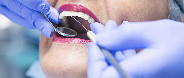 Best Emergency Tooth Extraction in Louise, TX